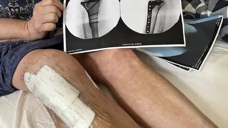 Oroande ökning av hundattacker i Stockholm – allt fler skadas
