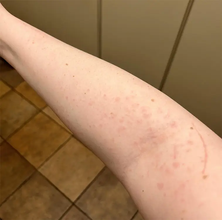 Allergisk mot hund? Läkaren varnar för att skaffa egen